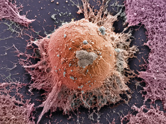 Embryonic Stem Cell
