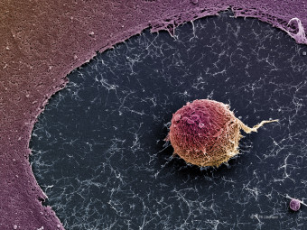Human Embryonic Stem Cell
