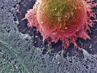 Human Embryonic Stem Cell