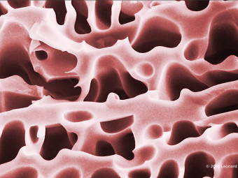 Lyophilized Follical Dtimulating Hormone (FSH)