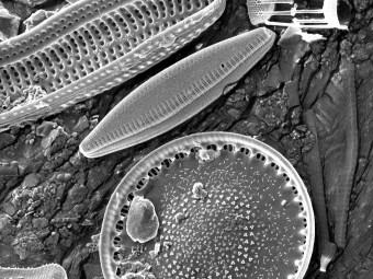 Myriad of Hudson River Diatoms and Diatom Fragents