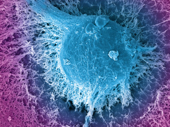 Human Embryonic Stem Cell