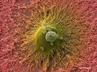 Human Embryonic Stem Cell