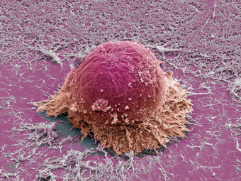 Human Embryonic Stem Cell