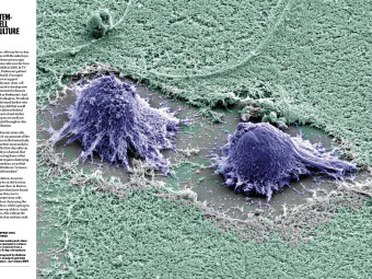 Human Embryonic Stem Cells  - Time Magazine Best Photos 2006