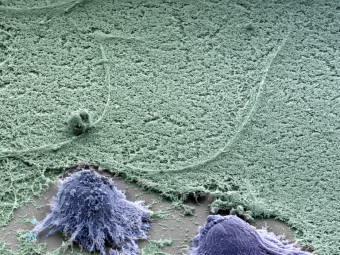 Human Embryonic Stem Cells