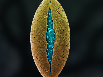 Tree Pollen from Central Park, New York, NY